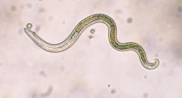 8 Ways to Compost Dog Waste at Home 2 microscopic_view_of_a_parasite